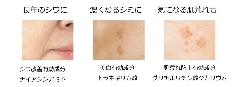 シワ、シミ、肌荒れの3大悩みにアプローチするイメージ