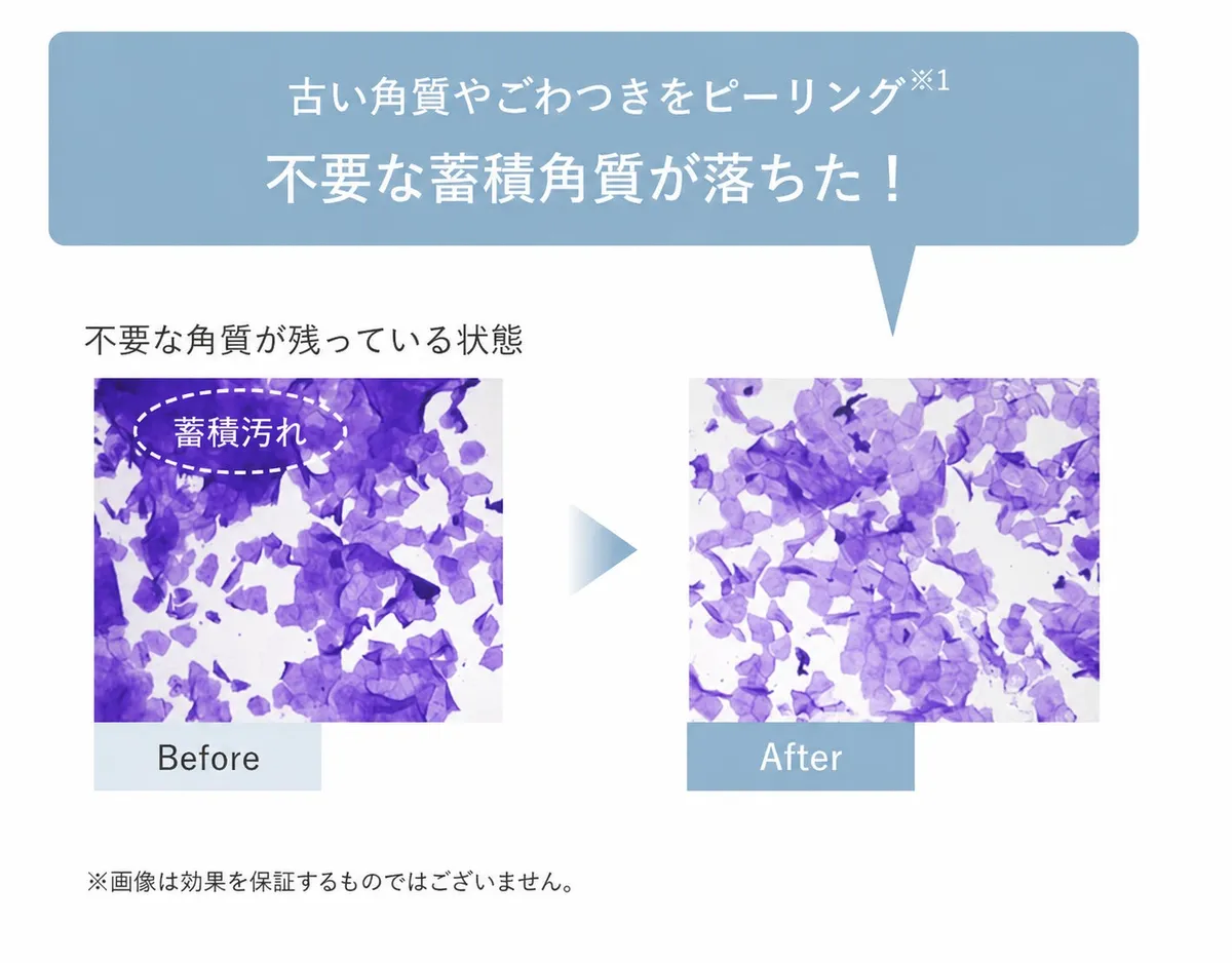 ピーリング効果を示す角質のBefore/After比較画像
