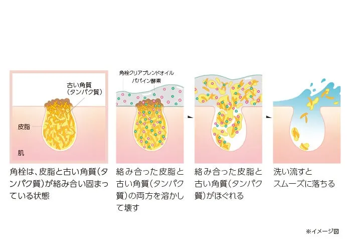 角栓除去のメカニズム