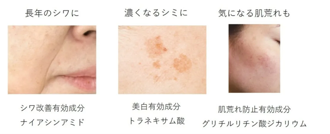 シワ・シミ・肌荒れの悩みと、それに対応する3つの有効成分の解説図