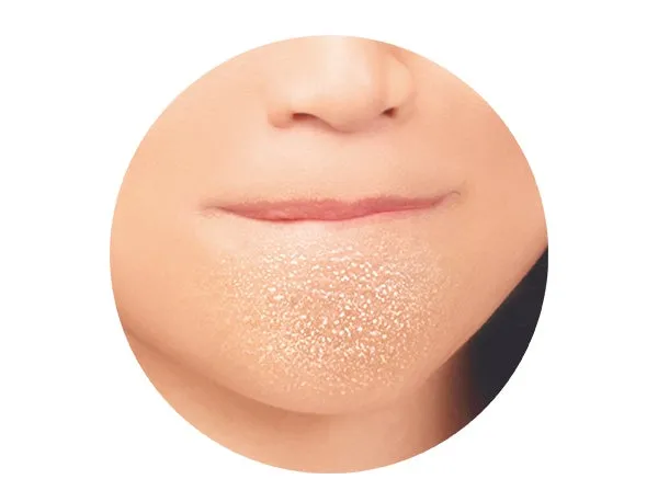 あごのざらつきが気になる肌の様子