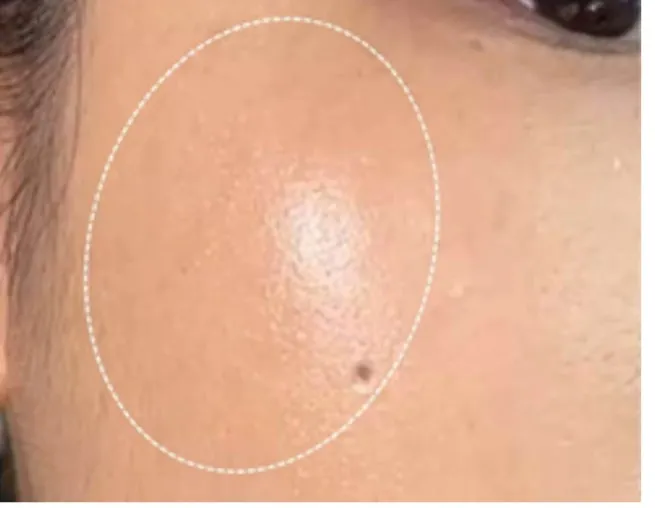 美容液を使用した後のツヤ溢れる肌のアップ