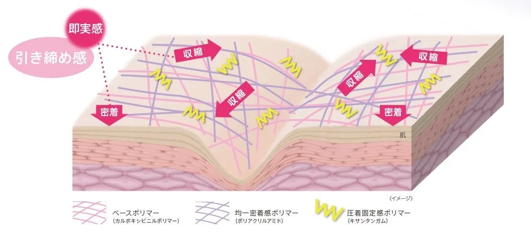 3Dタイトニングネット構造処方の仕組み